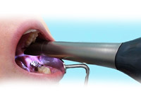 Cerec